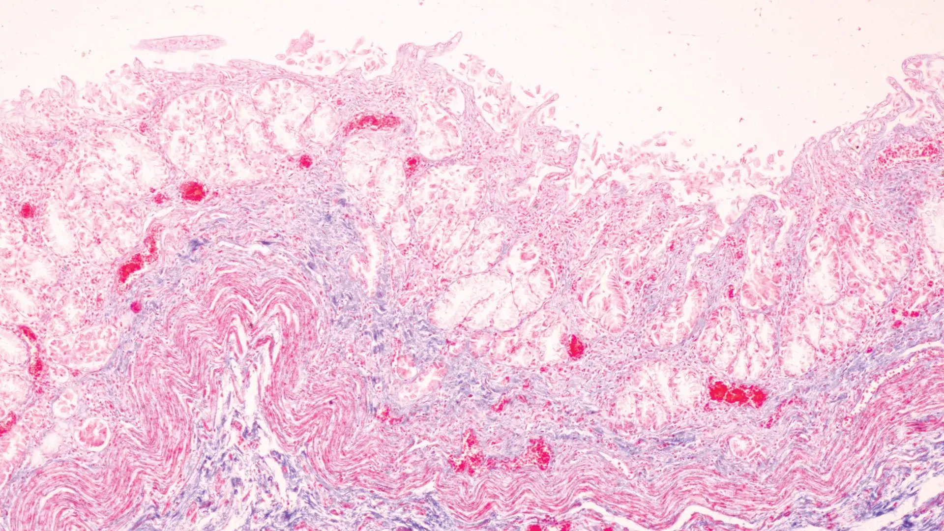 Stomach lining displaying GI Health